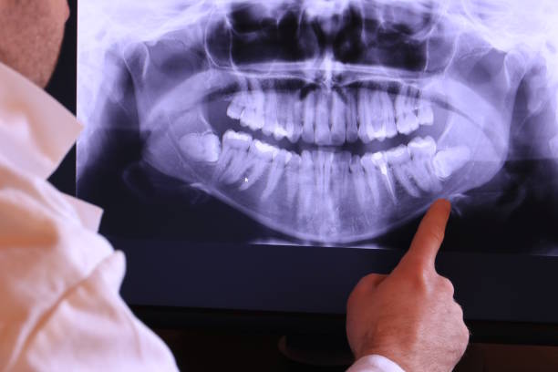Best Broken or Chipped Tooth Repair in Park Falls, WI